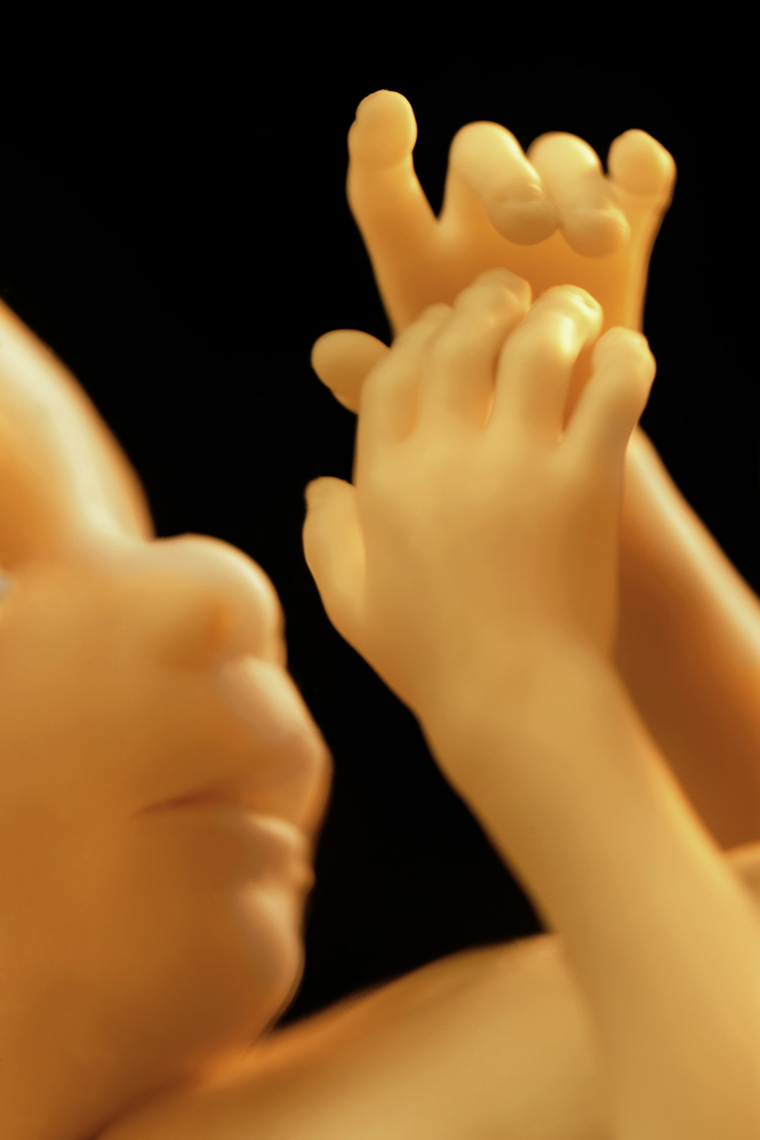 Human fetus, National Museum of Health and Medicine, Washington D.C., USA